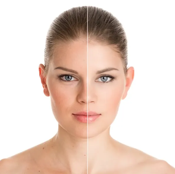 Advanced skin treatment at Riverflow